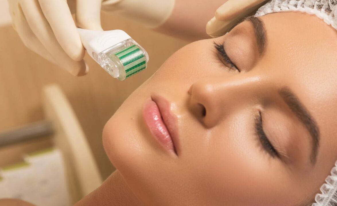 Mesoterapia